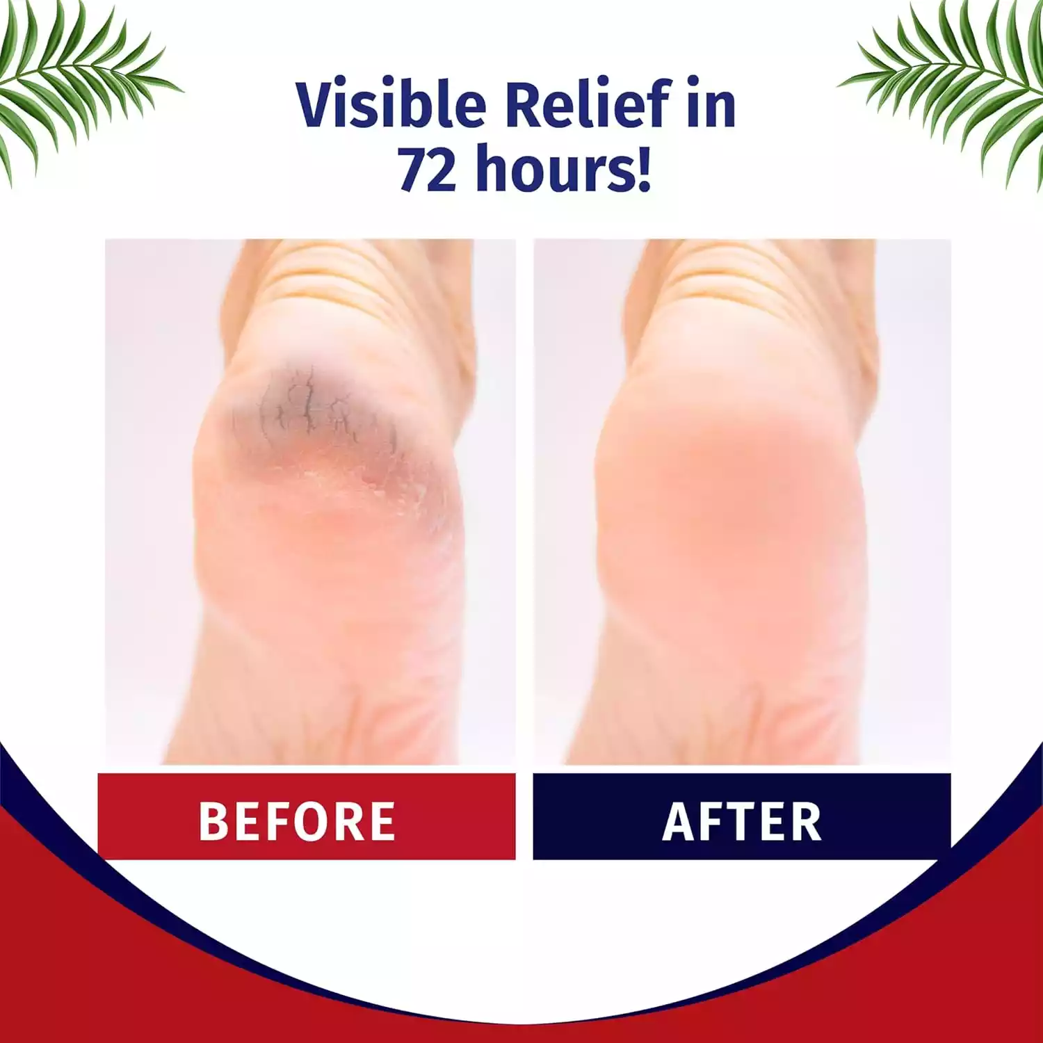 Softwalk Cracked Heel Repair Cream (1)